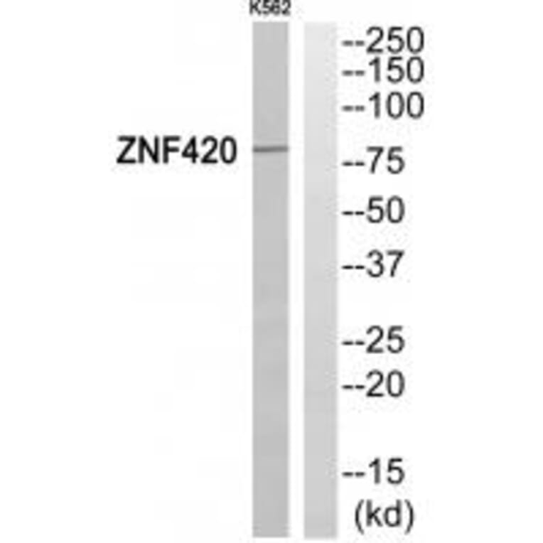Western blot - ZNF420 Antibody from Signalway Antibody (35157) - Antibodies.com