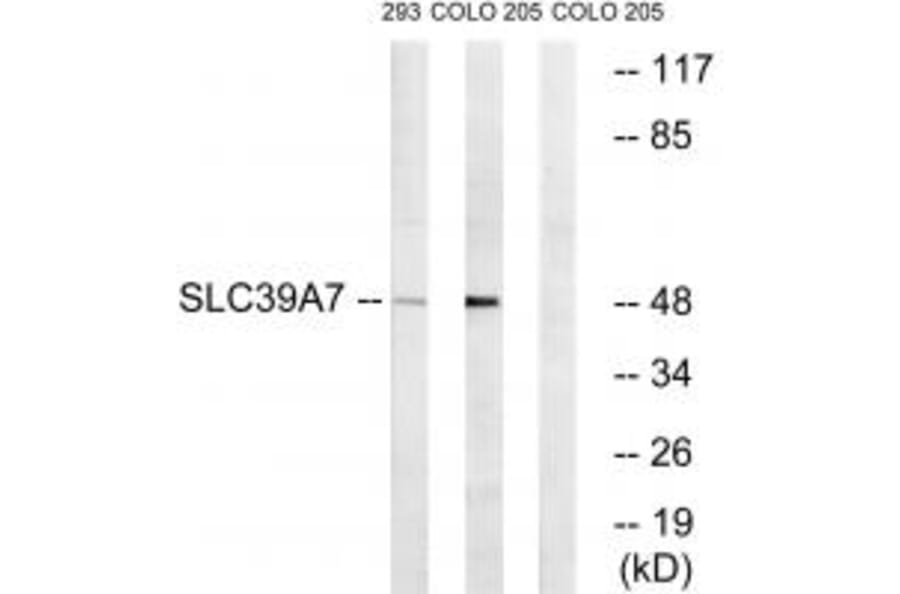 Western blot - SLC39A7 Antibody from Signalway Antibody (35162) - Antibodies.com