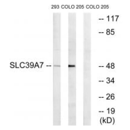 Western blot - SLC39A7 Antibody from Signalway Antibody (35162) - Antibodies.com