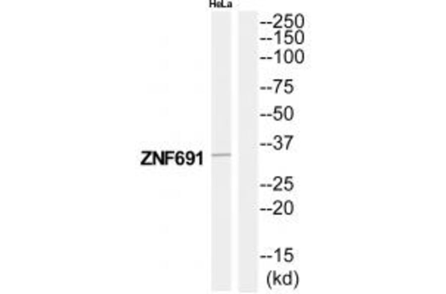 Western blot - ZNF691 Antibody from Signalway Antibody (35181) - Antibodies.com