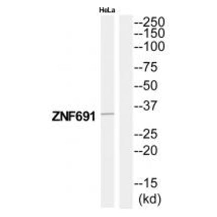 Western blot - ZNF691 Antibody from Signalway Antibody (35181) - Antibodies.com
