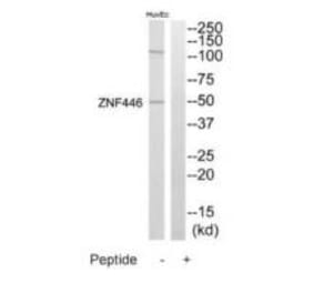 Western blot - ZNF446 Antibody from Signalway Antibody (35203) - Antibodies.com