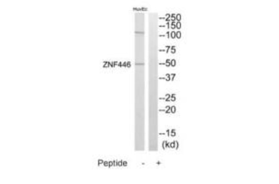 Western blot - ZNF446 Antibody from Signalway Antibody (35203) - Antibodies.com