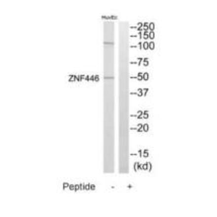 Western blot - ZNF446 Antibody from Signalway Antibody (35203) - Antibodies.com