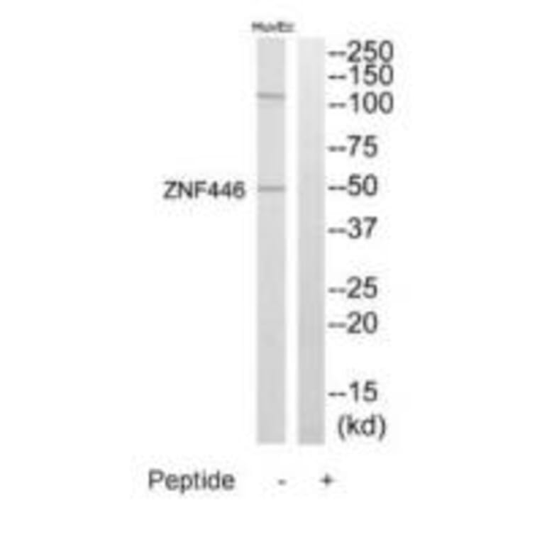 Western blot - ZNF446 Antibody from Signalway Antibody (35203) - Antibodies.com