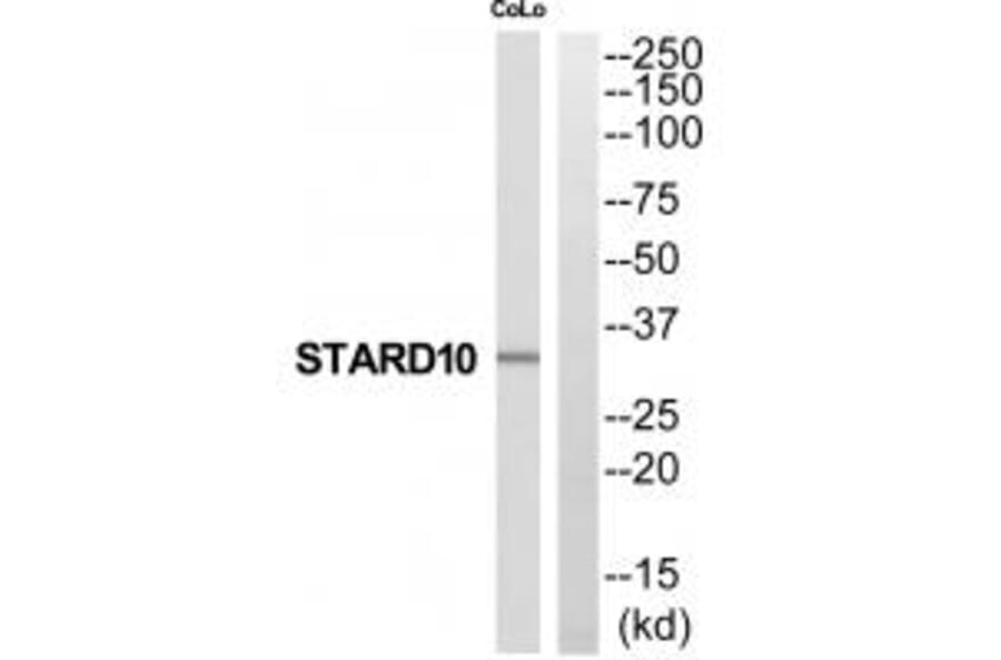 Western blot - STARD10 Antibody from Signalway Antibody (35208) - Antibodies.com