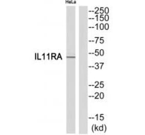 Western blot - IL11RA Antibody from Signalway Antibody (35221) - Antibodies.com
