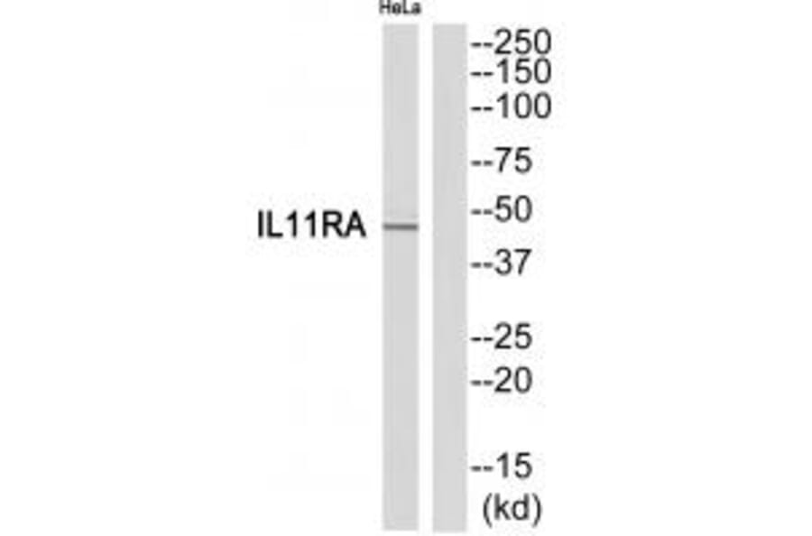 Western blot - IL11RA Antibody from Signalway Antibody (35221) - Antibodies.com