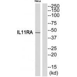 Western blot - IL11RA Antibody from Signalway Antibody (35221) - Antibodies.com