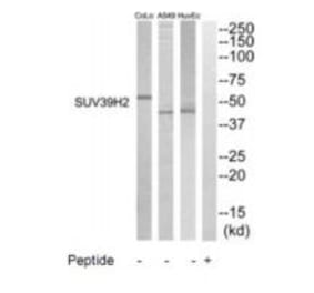 Western blot - SUV39H2 Antibody from Signalway Antibody (35236) - Antibodies.com