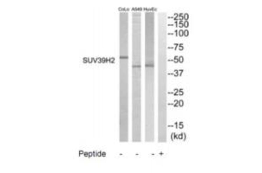 Western blot - SUV39H2 Antibody from Signalway Antibody (35236) - Antibodies.com