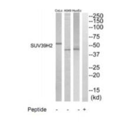 Western blot - SUV39H2 Antibody from Signalway Antibody (35236) - Antibodies.com
