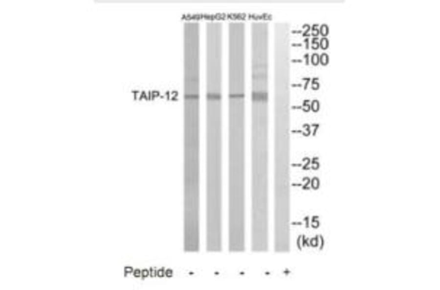 Western blot - TAIP-12 Antibody from Signalway Antibody (35237) - Antibodies.com