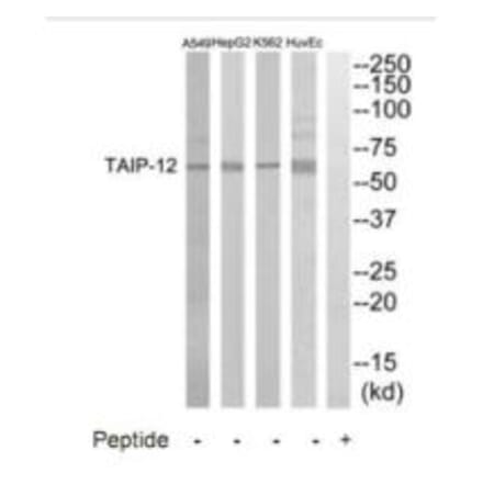 Western blot - TAIP-12 Antibody from Signalway Antibody (35237) - Antibodies.com