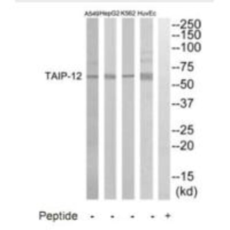 Western blot - TAIP-12 Antibody from Signalway Antibody (35237) - Antibodies.com