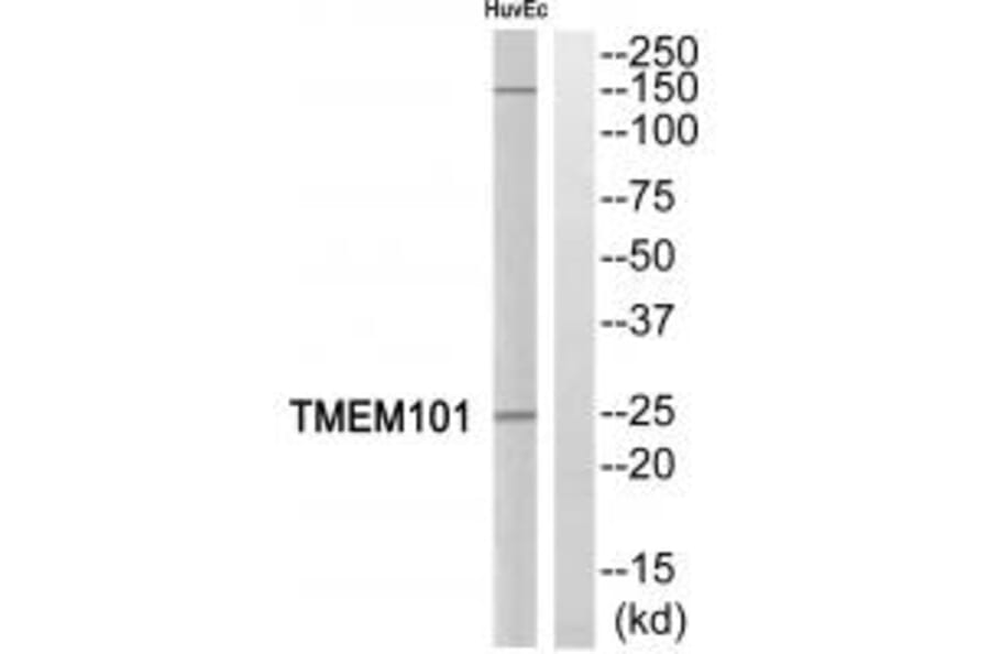 Western blot - TMEM101 Antibody from Signalway Antibody (35251) - Antibodies.com