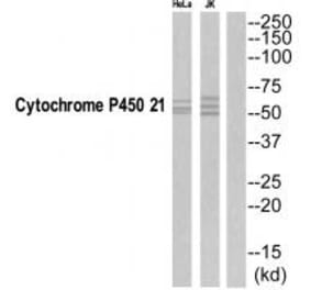 Western blot - CYP21A2 Antibody from Signalway Antibody (35263) - Antibodies.com