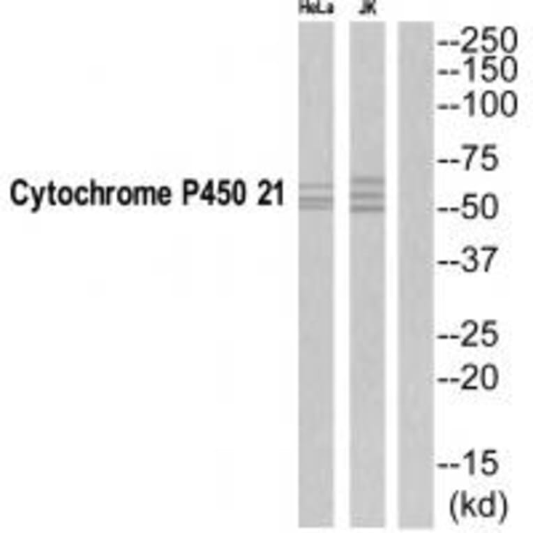 Western blot - CYP21A2 Antibody from Signalway Antibody (35263) - Antibodies.com