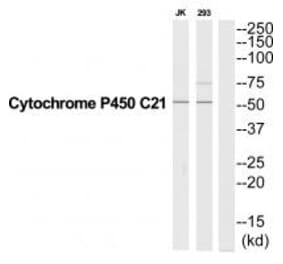 Western blot - CYP21A2 Antibody from Signalway Antibody (35264) - Antibodies.com