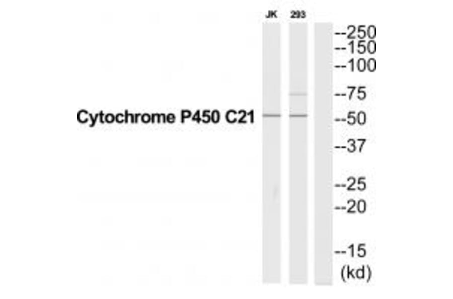Western blot - CYP21A2 Antibody from Signalway Antibody (35264) - Antibodies.com