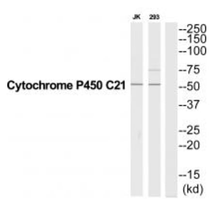 Western blot - CYP21A2 Antibody from Signalway Antibody (35264) - Antibodies.com