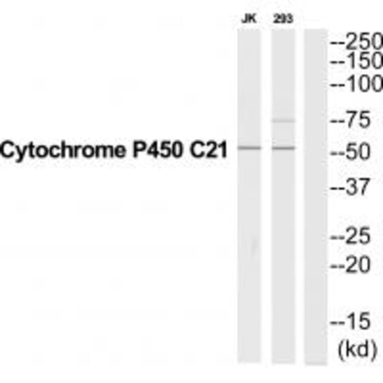 Western blot - CYP21A2 Antibody from Signalway Antibody (35264) - Antibodies.com