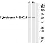 Western blot - CYP21A2 Antibody from Signalway Antibody (35264) - Antibodies.com
