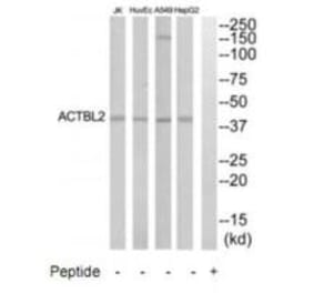 Western blot - ACTBL2 Antibody from Signalway Antibody (35303) - Antibodies.com