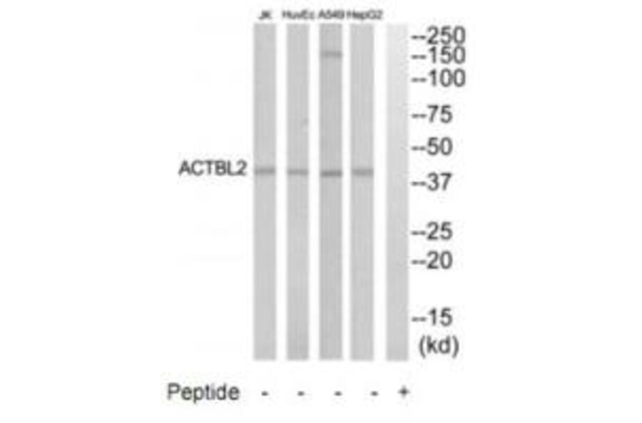 Western blot - ACTBL2 Antibody from Signalway Antibody (35303) - Antibodies.com