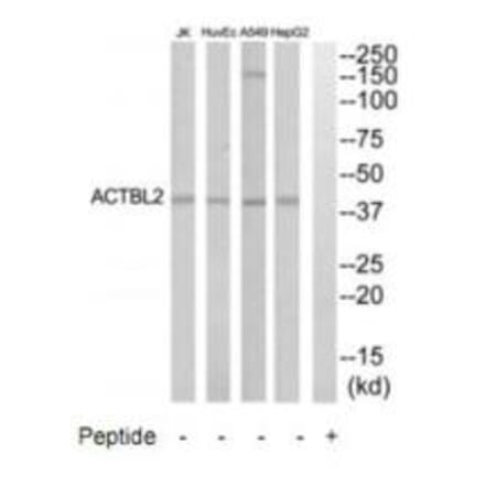 Western blot - ACTBL2 Antibody from Signalway Antibody (35303) - Antibodies.com