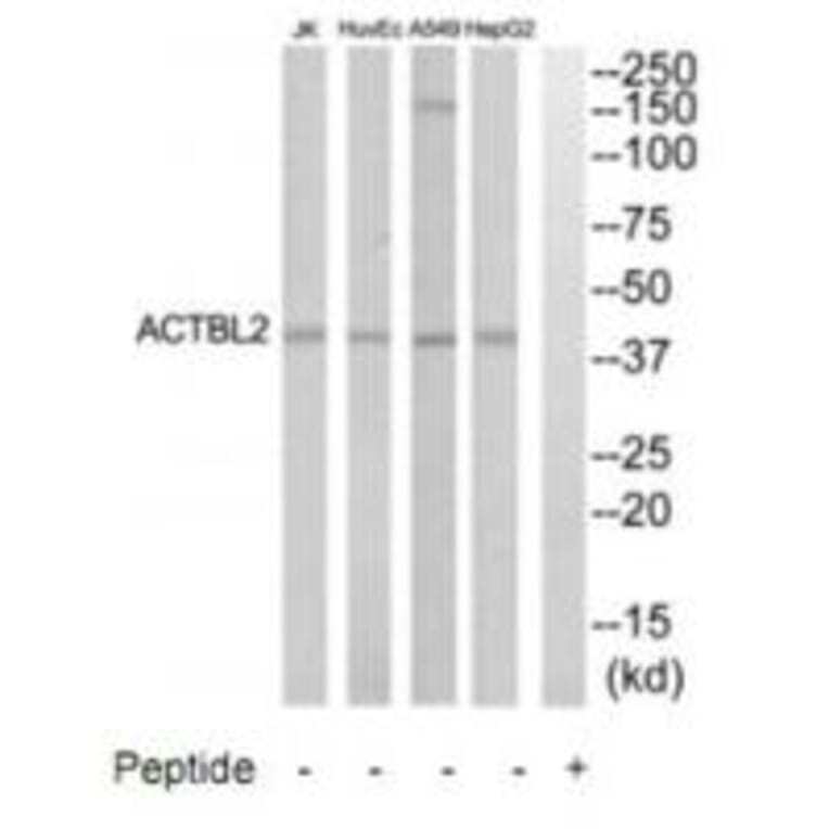 Western blot - ACTBL2 Antibody from Signalway Antibody (35303) - Antibodies.com