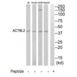 Western blot - ACTBL2 Antibody from Signalway Antibody (35303) - Antibodies.com