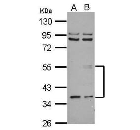 ANGPTL3 Antibody from Signalway Antibody (35462) - Antibodies.com