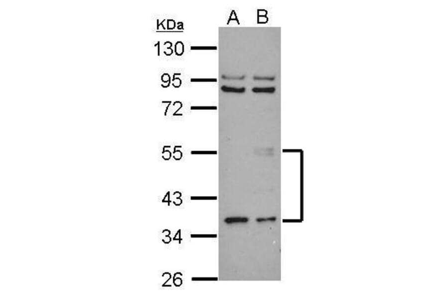 ANGPTL3 Antibody from Signalway Antibody (35462) - Antibodies.com