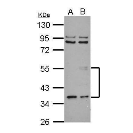 ANGPTL3 Antibody from Signalway Antibody (35462) - Antibodies.com
