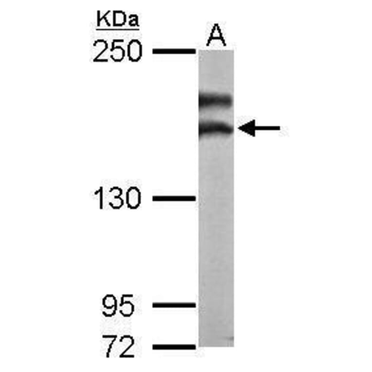 NMDAR2B Antibody from Signalway Antibody (35467) - Antibodies.com