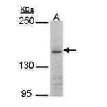 NMDAR2B Antibody from Signalway Antibody (35467) - Antibodies.com