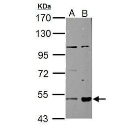 ALDH3A2 Antibody from Signalway Antibody (35473) - Antibodies.com