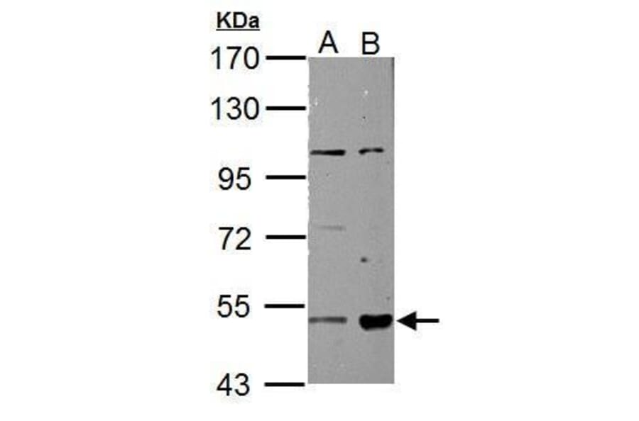 ALDH3A2 Antibody from Signalway Antibody (35473) - Antibodies.com