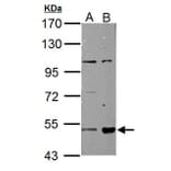 ALDH3A2 Antibody from Signalway Antibody (35473) - Antibodies.com
