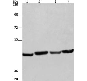 RBMY1A1 Antibody from Signalway Antibody (35556) - Antibodies.com