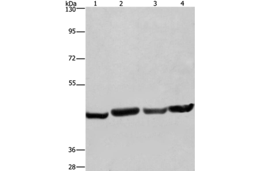 RBMY1A1 Antibody from Signalway Antibody (35556) - Antibodies.com
