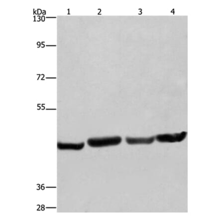 RBMY1A1 Antibody from Signalway Antibody (35556) - Antibodies.com