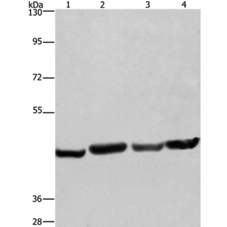 RBMY1A1 Antibody from Signalway Antibody (35556) - Antibodies.com