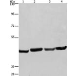 RBMY1A1 Antibody from Signalway Antibody (35556) - Antibodies.com