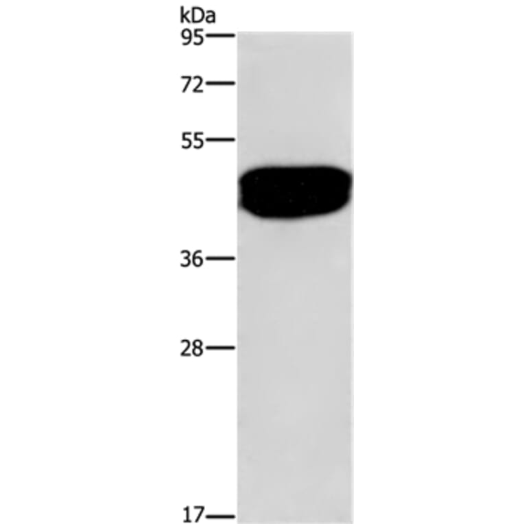 SDCCAG3 Antibody from Signalway Antibody (35706) - Antibodies.com