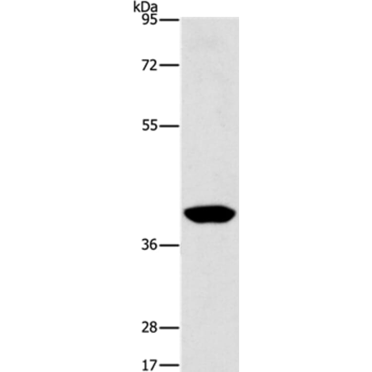 AGXT2L2 Antibody from Signalway Antibody (36066) - Antibodies.com