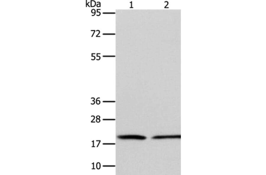 ANAPC13 Antibody from Signalway Antibody (36114) - Antibodies.com