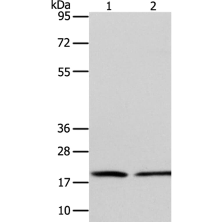 ANAPC13 Antibody from Signalway Antibody (36114) - Antibodies.com