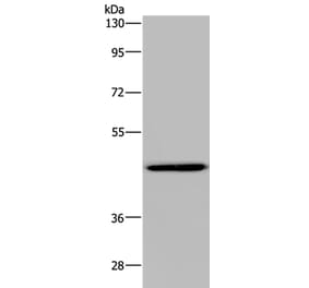 GTPBP10 Antibody from Signalway Antibody (36516) - Antibodies.com